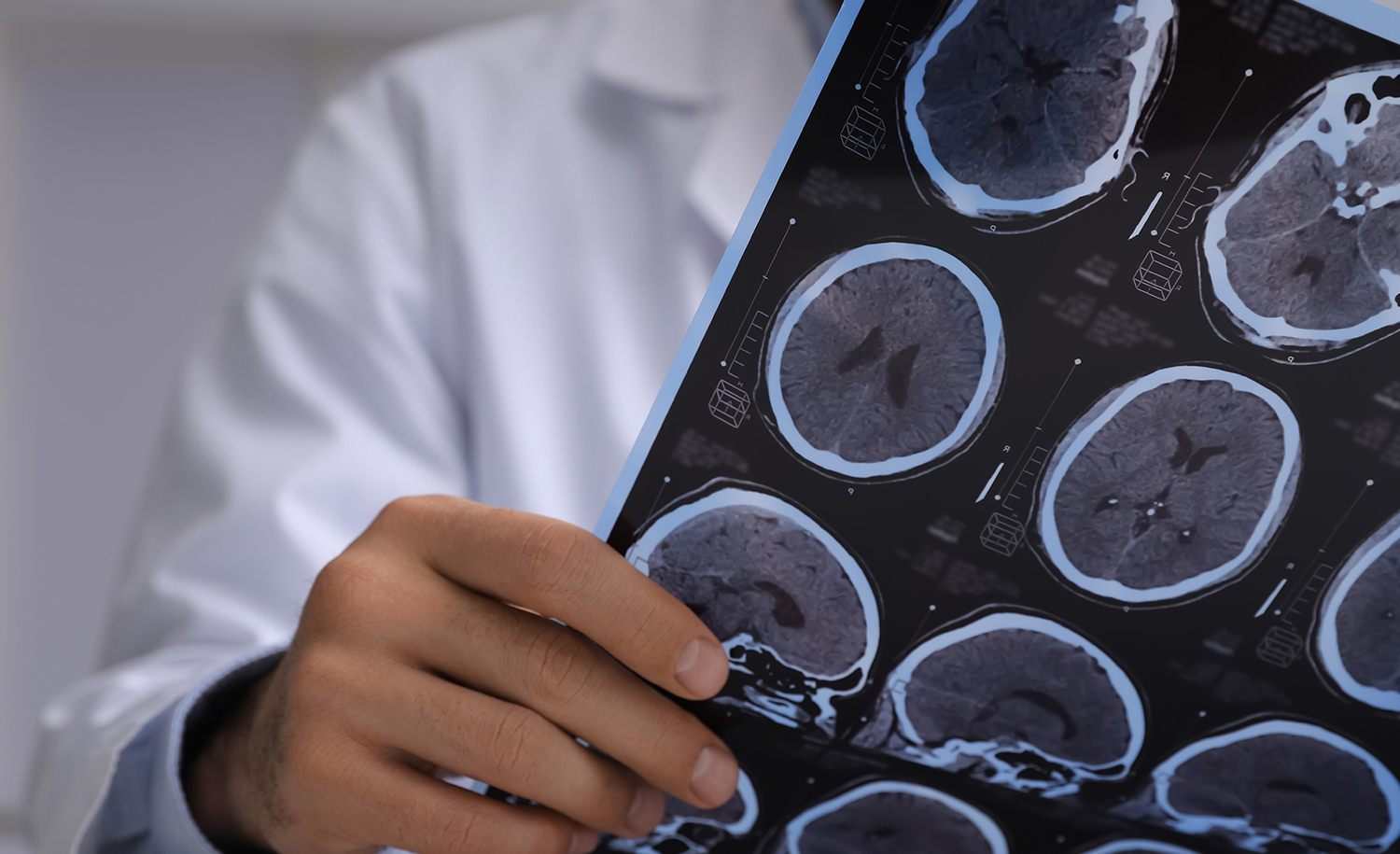 A doctor holding up a patients brain scan results.